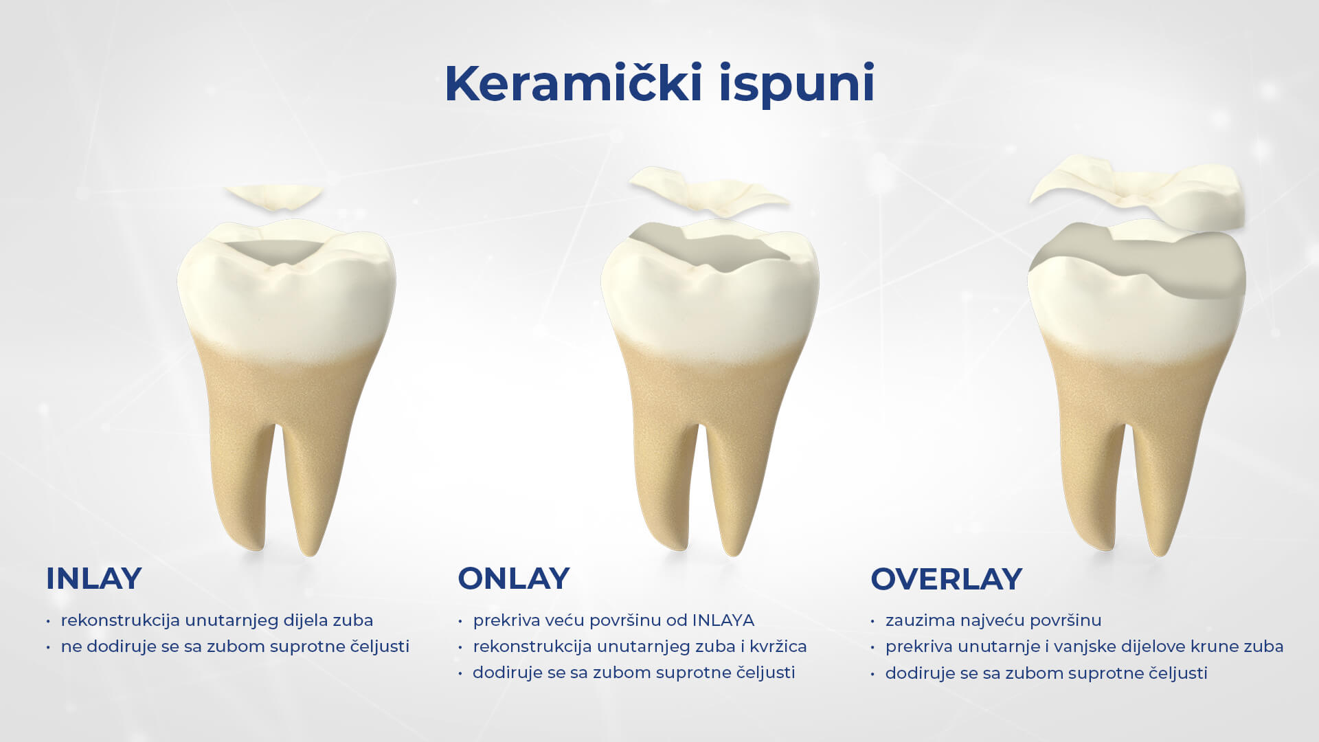 Zubna protetika- cirkon-keramika, keramika, metal-keramika