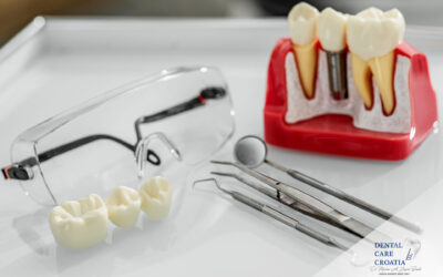 Koja je uloga privremenog (imedijatnog) mosta u dentalnoj medicini?