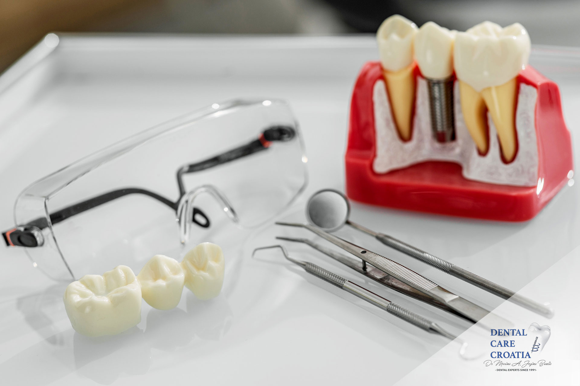 Imamo više od dvadeset godina iskustva u izradi privremenih i trajnih dentalnih protetskih rješenja. Specijalizirani smo za ugradnju implantata i za implanto-protetske koncepte All on 4 i All on 6, koji prvo zahtijevaju izradu imedijatnog, a nakon 3-6 mjeseci i trajnog mosta. Naša privremena rješenja maksimalno zadovoljavaju sve funkcije ‒ žvakanje, govor i estetiku. Želite li uljepšati svoj osmijeh, do izrade definitivnih krunica, osigurat ćemo vam privremeno rješenje kako bismo zaštitili vaše prirodne brušene zube od vanjskih utjecaja i osigurali vam lijep privremeni osmijeh dok s trajnim mostom ne zasjate u punom sjaju. Kontaktirajte nas na broj +385 21 360 270 ili putem e-mail adrese info@dental-care-croatia.com.