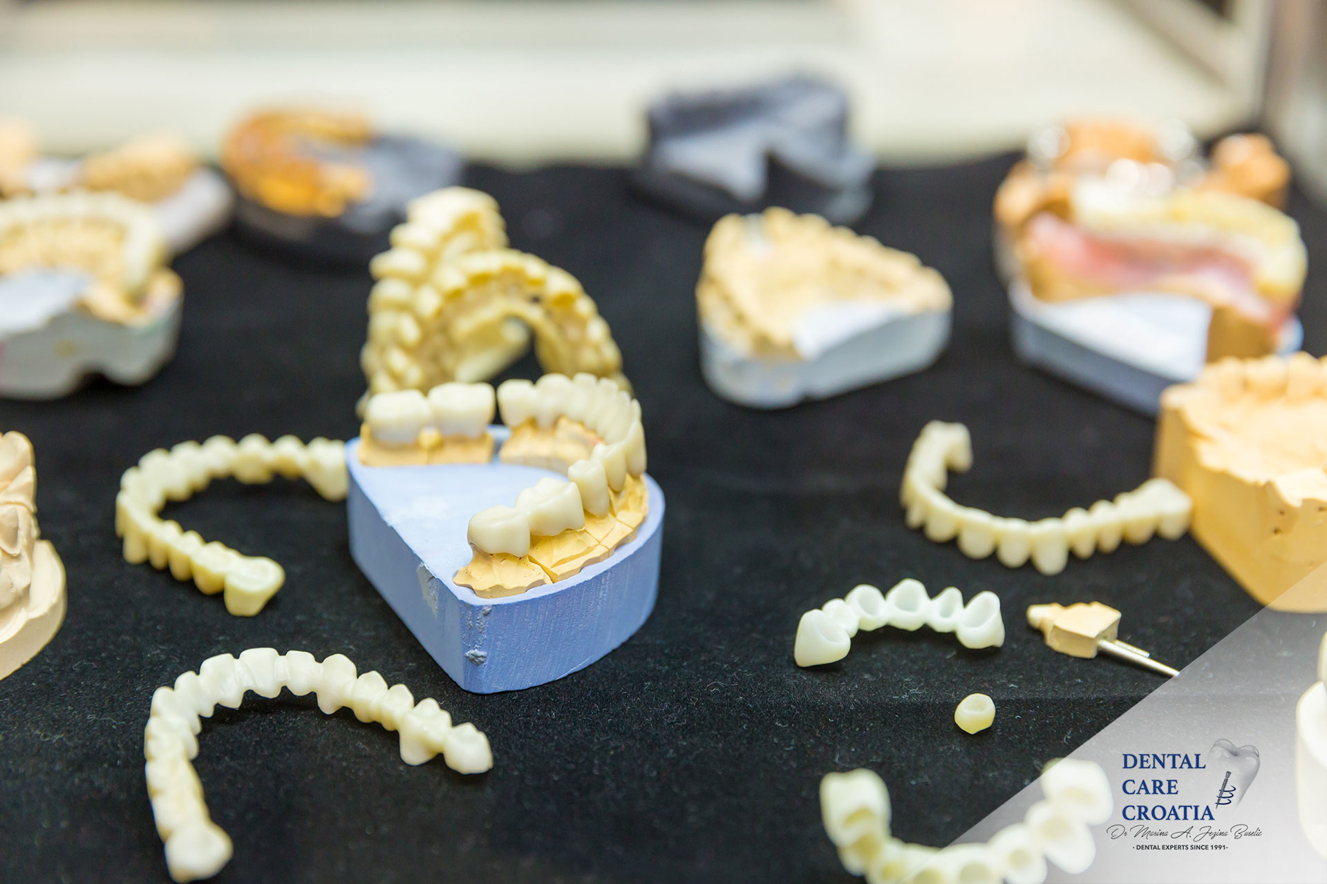 imedijatni most, trajni most – Dental Care Croatia